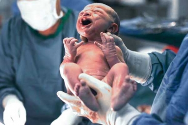 C-Section Deliveries Nearly Doubled Worldwide Since 2000: Study C-Section Deliveries Nearly Doubled Worldwide Since 2000: Study