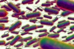 E.coli Outbreak United Kingdom, E.coli Outbreak, all about e coli outbreak in the united kingdom, Boots