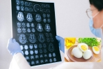 Eggs and Alzheimer’s breakfast, Eggs, eggs may help prevent alzheimer s study, Nutrition