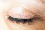 Eyelash Dandruff treatment, Eyelash Dandruff medication, all about eyelash dandruff, Makeup
