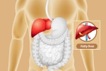 Fatty Liver symptoms, Fatty Liver health, dangers of fatty liver, Calories