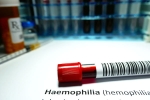 Hemophilia for men, Hemophilia among men, why are men likely to develop hemophilia, Doctors