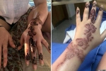 henna, black henna tattoo burns, henna tattoo cause aussie woman to almost lose her hand, Aswan
