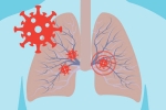 Kawasaki disease, cytokine storm syndrome, how does covid 19 affect different parts of the body, Spanish flu