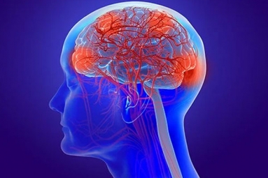 Coronavirus Can Cause Long-Term Loss of Brain Tissue