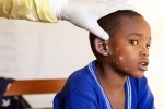 Monkeypox Outbreak breaking, Monkeypox Outbreak breaking, is monkeypox outbreak coming to india, Monkey