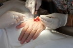 cancer pain treatment, skin cancer causes, cancer treatment can now be pain free, Liver cancer