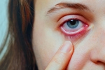 Conjunctivitis research, Conjunctivitis in India, special measures to prevent conjunctivitis, Eyes health