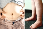 Water Retention health tips, Water Retention food, some effective ways to reduce water retention, Heart diseases