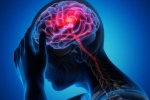 Canada Brain Disease cause, Canada Brain Disease news, canada is hit by a mysterious brain disease, Canada brain disease