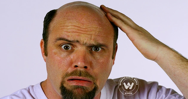 What's your balding hair strategy?},{What's your balding hair strategy?